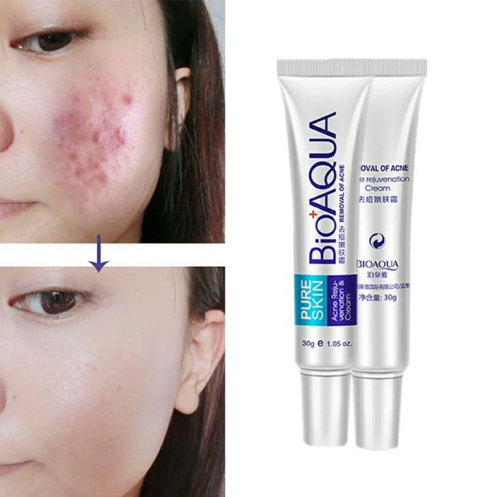 COMBO ANTI ACNE BIOAQUA + CAJA DE SEG